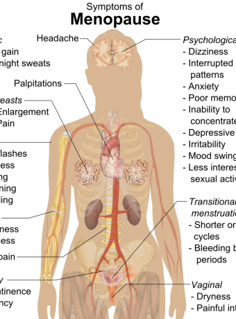 fibroids during menopause